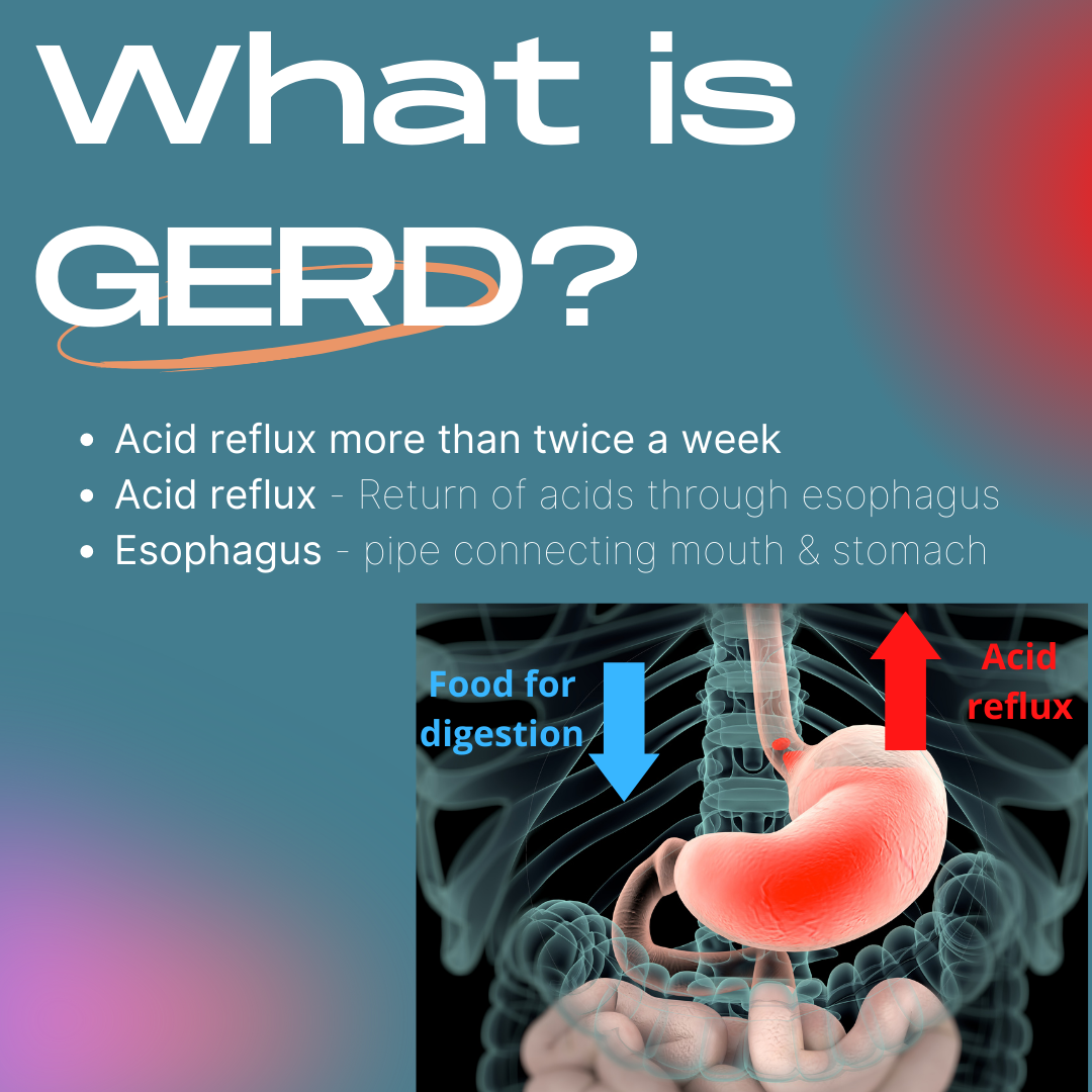 Causes, prevention and treatment for GERD / ACIDITY / ACID REFLUX